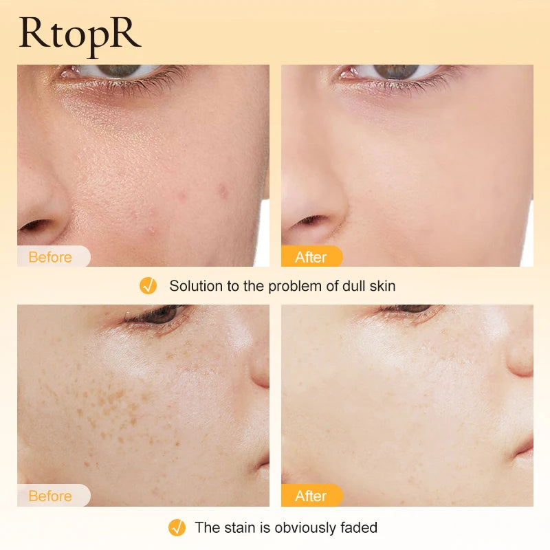 Whitening Serums Moisturizing Wrinkle Lifting Firming Skin Care Korean Blemish Skin Care Products Health Beauty