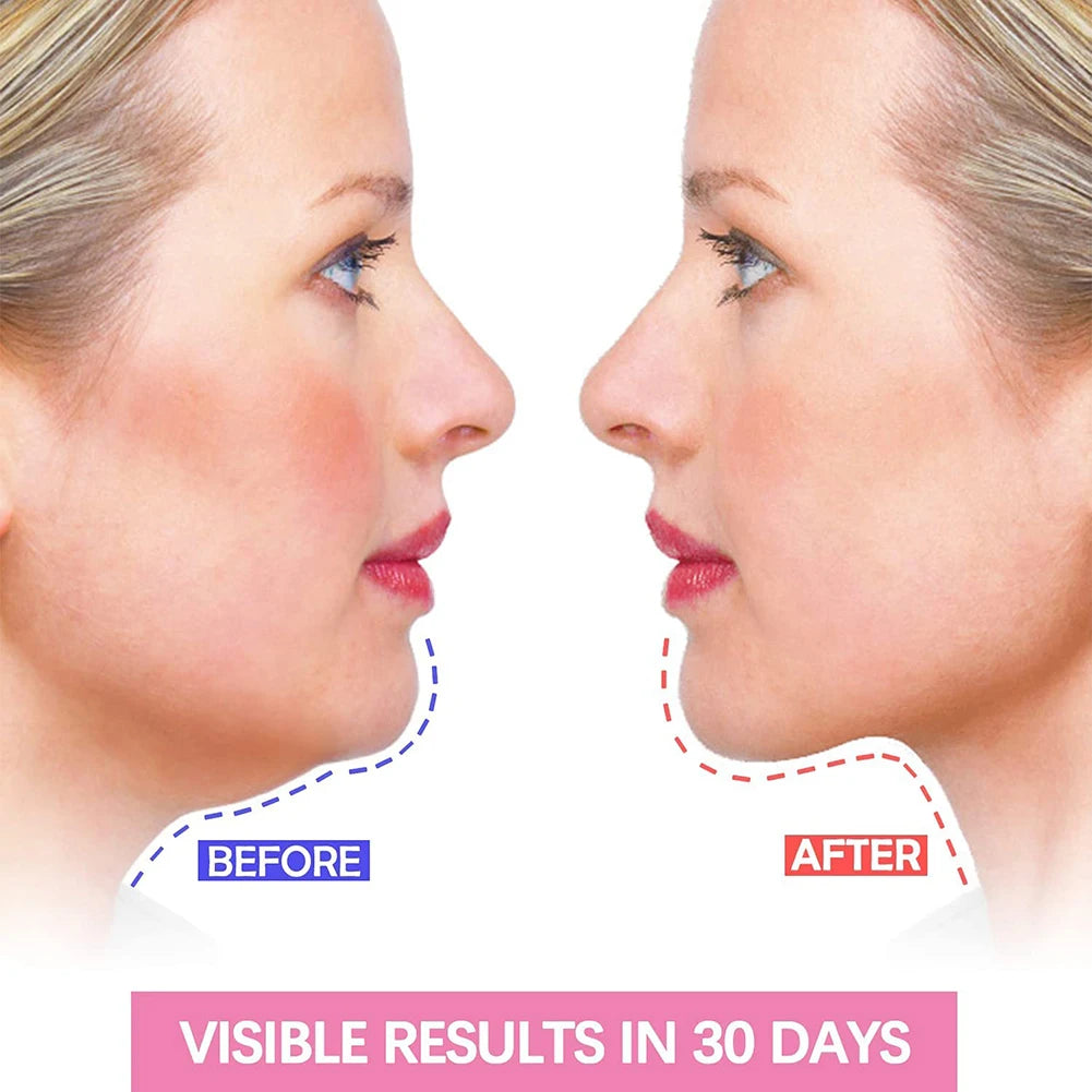 Slimming Facial V-Face Band Infrared Cheek Lifting Face Women Reduce Double Chin Skin Facial Massager Skin Care