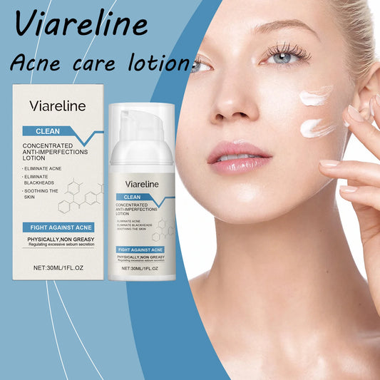 Viareline Face Skin Care Lotion Acne Treatment Eliminate Blackheads Soothing Skin Reduce Redness Non-greasy Acne Care Lotion
